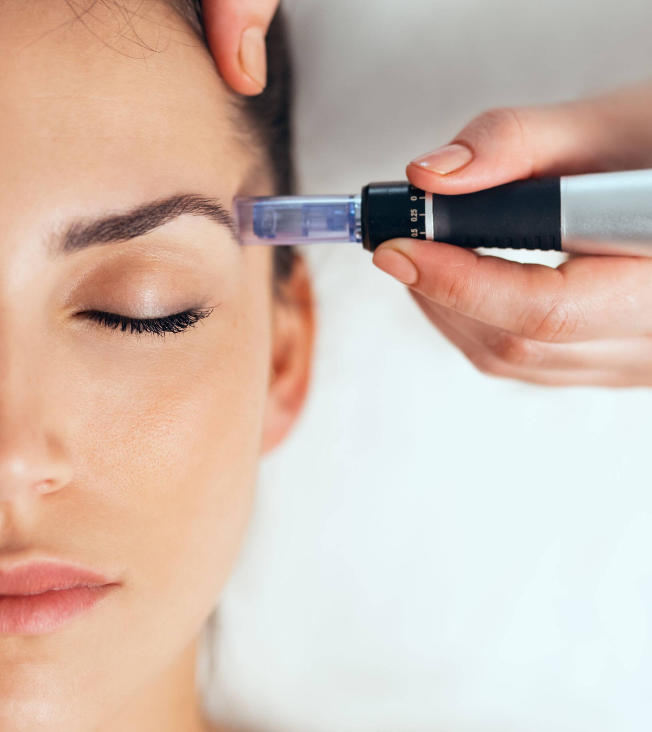 DERMAPEN (MICRONEEDLING)